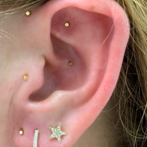 Close-up of an Ear after Auriculotherapy | Auriculotherapy