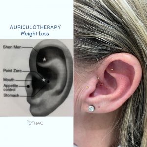 Diagram of Auriculotherapy | Auriculotherapy