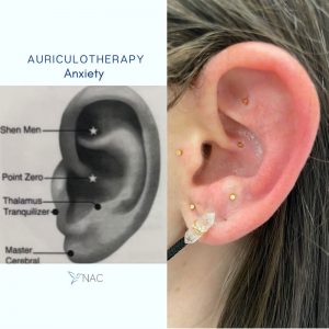 Diagram of Auriculotherapy | Auriculotherapy