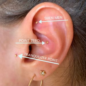 Diagram of Auriculotherapy | Auriculotherapy